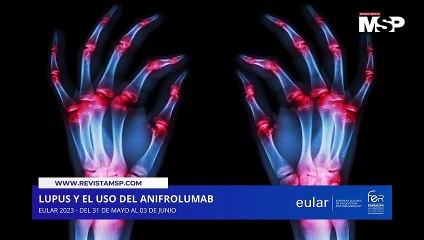 Uso del anifrolumab en Lupus y riñones - #EULAR #CoberturaEspecialMSP