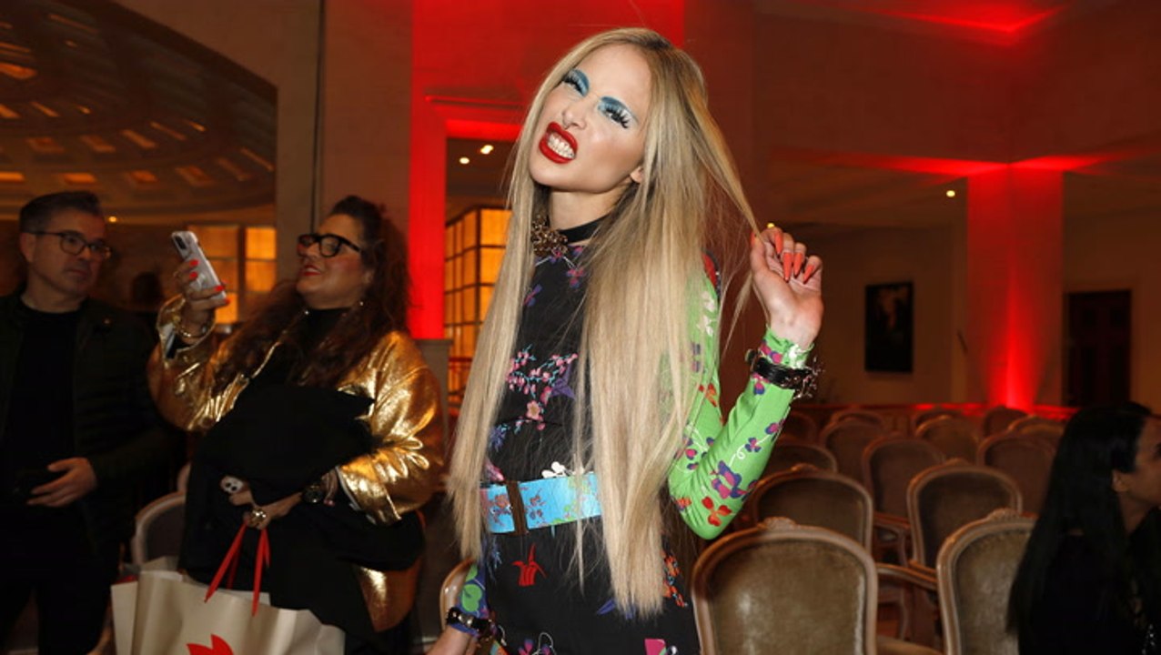 Theresia Fischer: Die krasse Wahrheit hinter ihrer Beinverlängerung