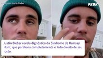 Justin Bieber e a Síndrome de RAM: entenda a condição que paralisou rosto do cantor