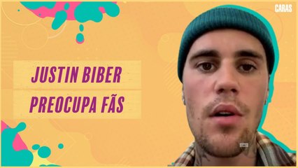 JUSTIN BIEBER REVELA QUE ESTA COM PARALISIA FACIAL E PREOCUPA FÃS