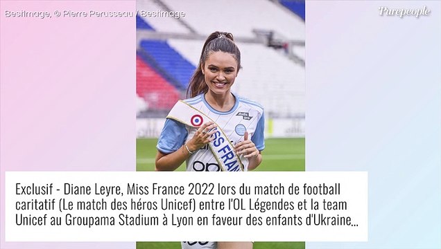 J'aurais pu perdre la vue : révélation de Diane Leyre (Miss France) sur l'origine de sa cicatrice