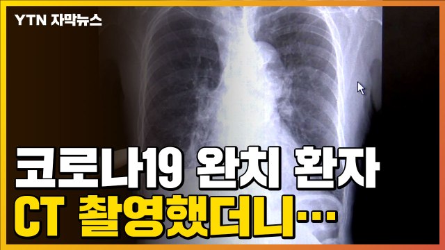 [자막뉴스] 치료 가이드라인 시급 ...코로나19 후유증 실태 조사 결과 / YTN