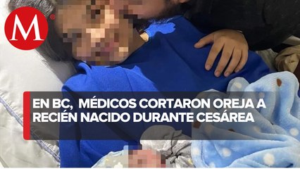 En BC, acusan que médicos cortaron oreja a recién nacido durante cesárea