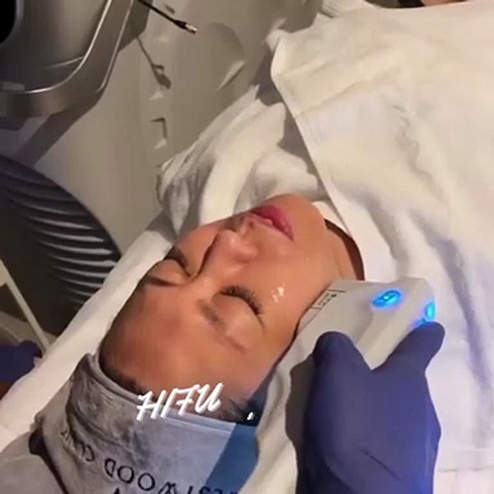 Hifu 1
