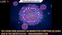 CDC Issues New Guidance on Monkeypox Symptoms as Cases Rise in the United States - 1breakingnews.com