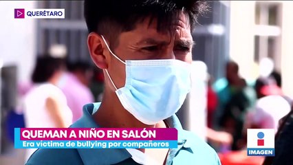 Rocían de alcohol y prenden fuego a estudiante de secundaria en Querétaro