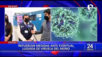 Viruela del Mono: refuerzan medidas de diagnóstico en Aeropuerto Jorge Chávez