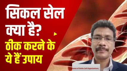 World Sickle Cell Day 2022: क्या होता है सिकल सेल रोग और ये क्यों होता इसका इलाज क्या है ?