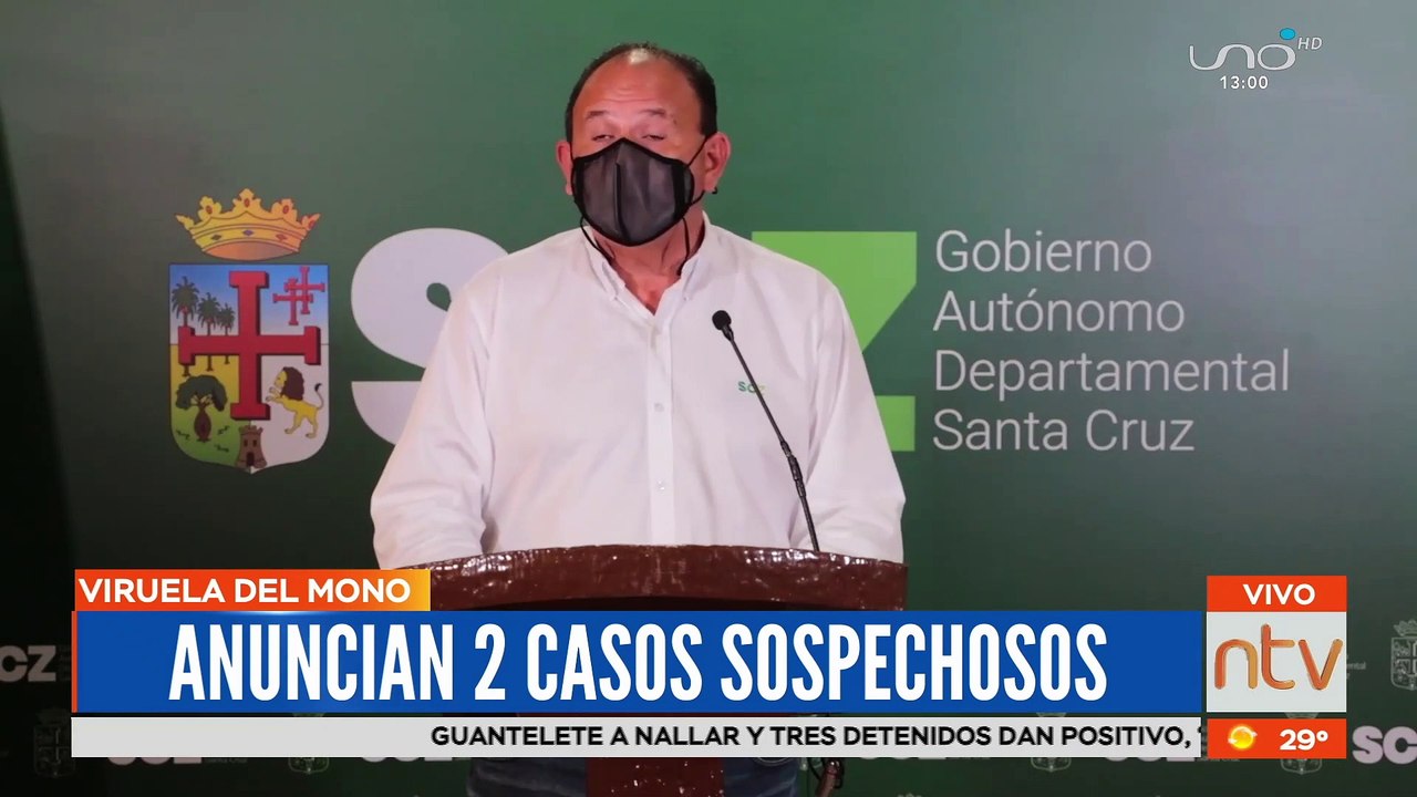 Anuncian dos casos sospechosos de viruela del mono