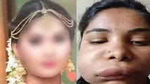 Kannada Actress Swati sathish का Surgery ने बिगाड़ा Face,Watch Video | Boldsky *Entertainment