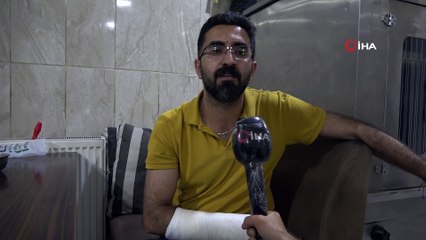 Kadını kurtarmak isterken hem ısırıldı hem kolu kırıldı