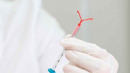 Schwanger trotz Kupferspirale: So sicher ist das hormonfreie Verhütungsmittel