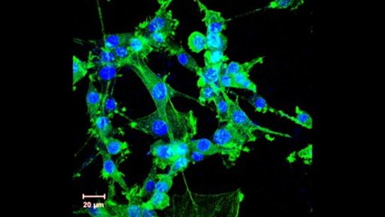 Melbourne researchers pioneering organ cryopreservation
