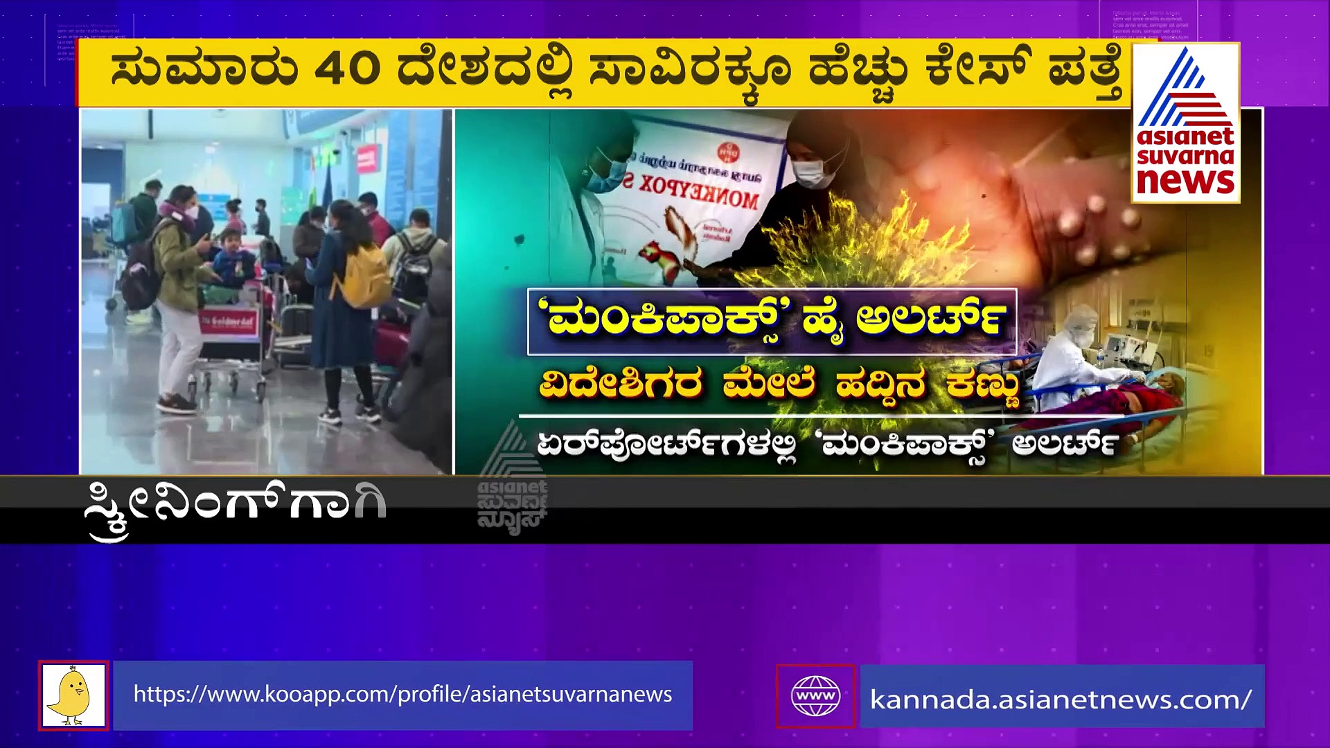 ಮಂಕಿಪಾಕ್ಸ್ ವೈರಸ್ ಭೀತಿ: ಕರ್ನಾಟಕದಲ್ಲಿ ಹೈಅಲರ್ಟ್‌..!