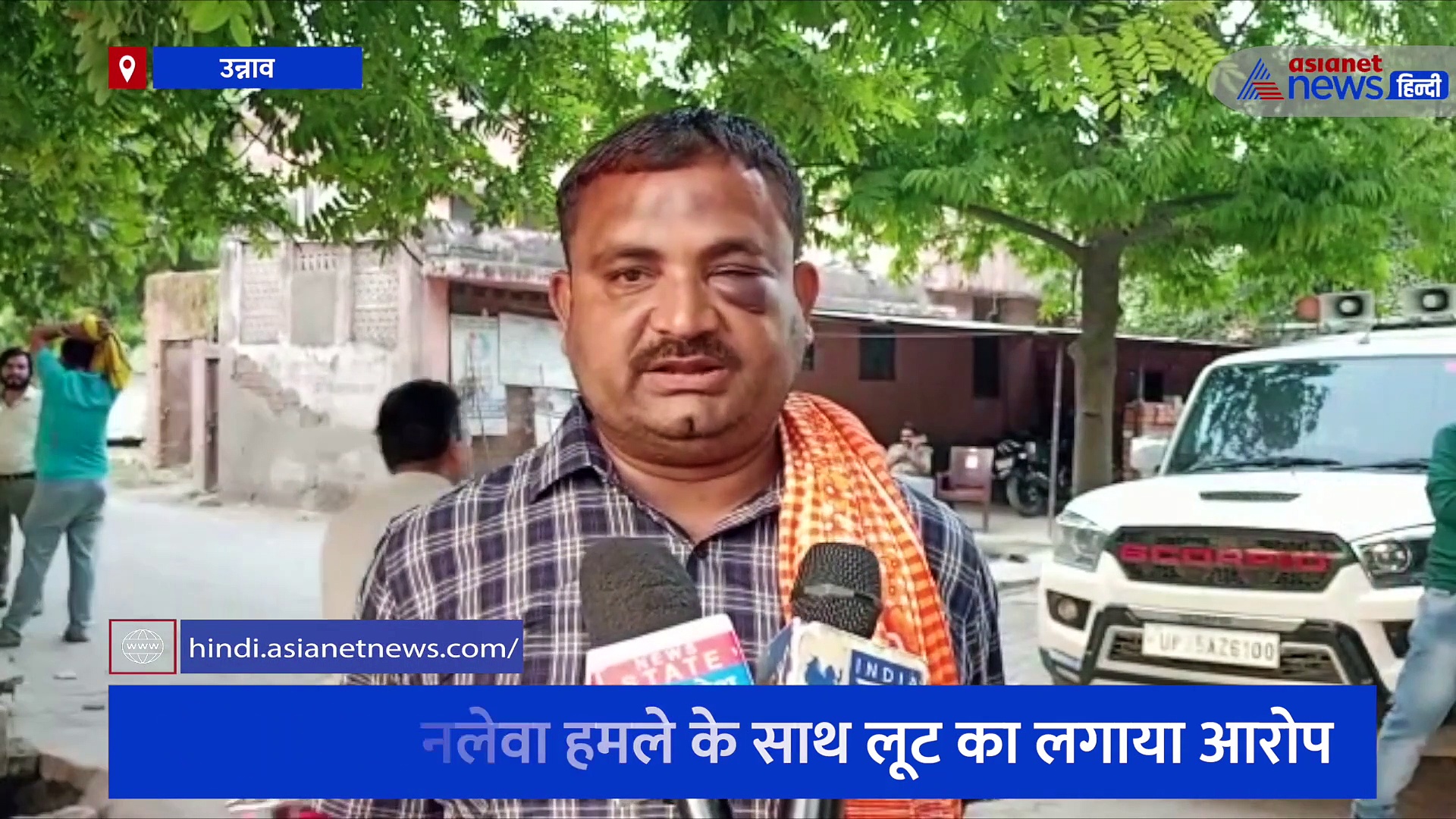 'इतना मारा की सूज गई आंख'...उन्नाव के रिटायर्ड फौजी ने बताया- कैसे उसपर टूट पड़े दर्जनों भाजपा समर्थक