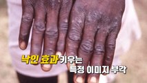 [더뉴스] '원숭이두창' 확산보다 무섭게 퍼지는 편견 / YTN