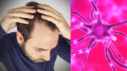 लड़कों में गंजापन जल्दी होने का कारण । लड़कों में गंजापन क्यों जल्दी आता है? । Boldsky । *Health