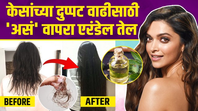 केसांच्या वाढीसाठी एरंडेल तेल लावताय? | How To Grow Your Hair Faster | Castor Oil For Hair Growth