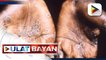 Singapore, kinumpirma ang kanilang unang kaso ng monkepox at una ring kaso sa Southeast Asia