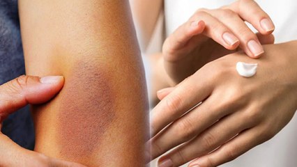 पतली स्किन होने क्या कारण है, Patli Skin Hone ka kya karan Hai | Boldsky *Health