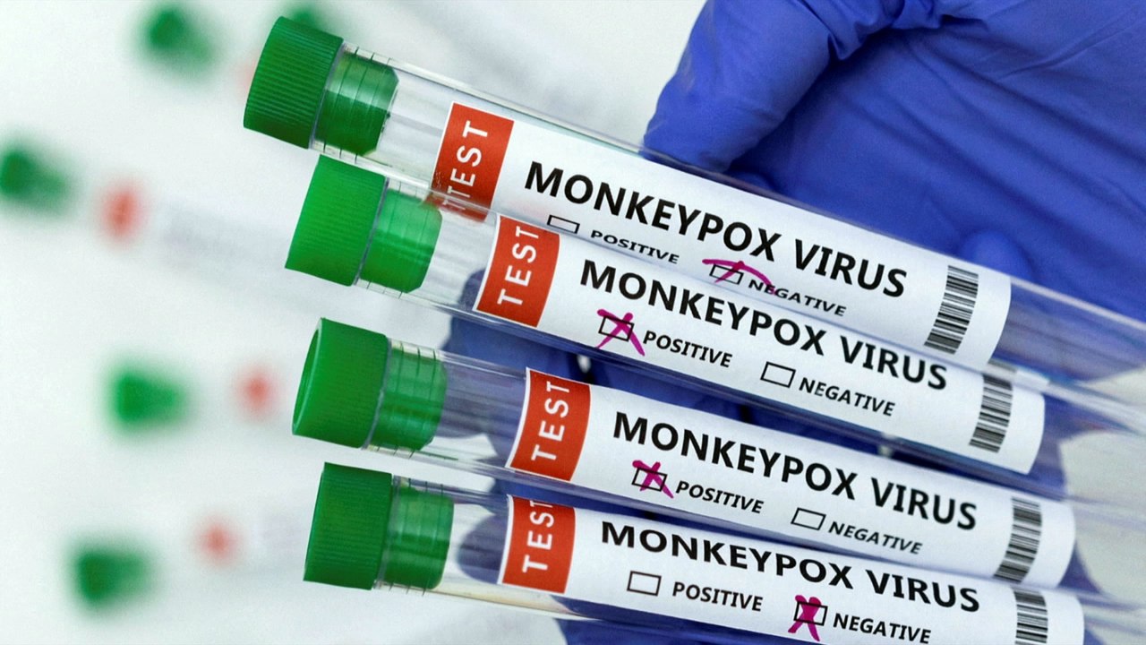 MONKEY POX, A RISK IN PREGNANCY