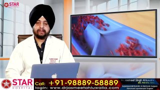 Varicose Veins Treatment In Hindi, Causes, Complications, Treatment, LASER Surgery, blood Clot Leg