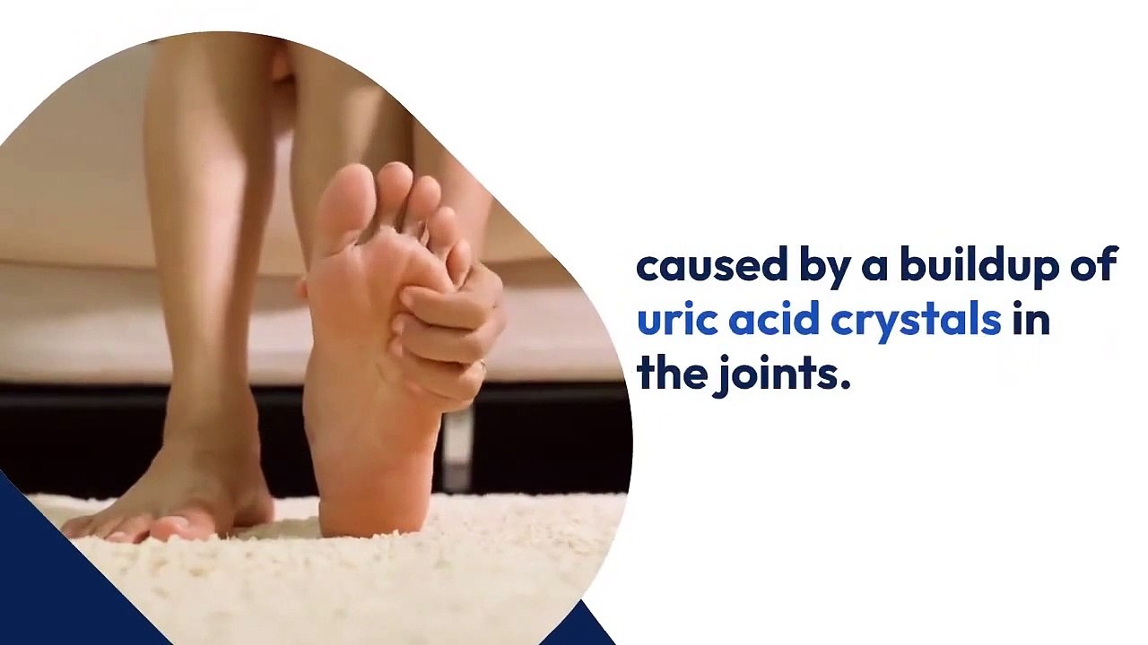 Austin TX Foot Doctor Gout Prevention