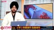 Varicose Veins Treatment In Hindi, Causes, Complications, Treatment, LASER Surgery, blood Clot Leg