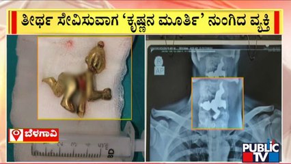 Man Accidentally Swallows Statue Of Lord Krishna In Belagavi | Public TV