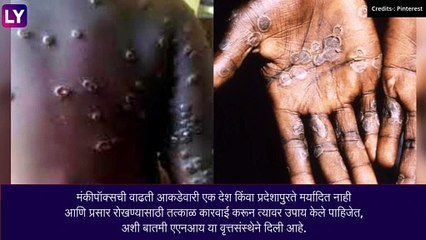 Monkeypox चा उद्रेक जागतिक चिंता, जागतिक महामारी घोषित- जागतिक आरोग्य संघटना