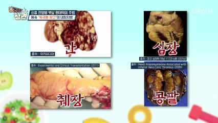 생명을 앗아가는 내 몸속 독극물 창고 ‘내장지방’ TV CHOSUN 20220624 방송