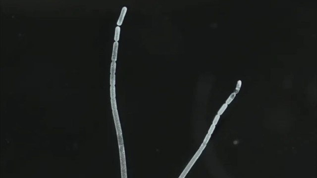 Forscher entdecken größtes Bakterium der Welt