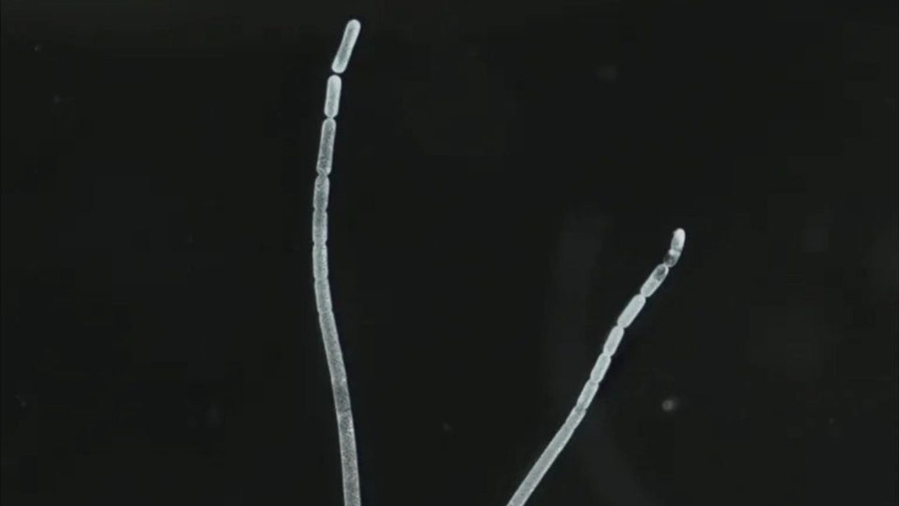 Forscher entdecken größtes Bakterium der Welt