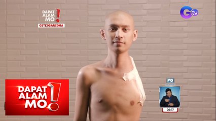 Binatang tinamaan ng cancer sa buto, kinailangang putulin ang isang braso! | Dapat Alam Mo!