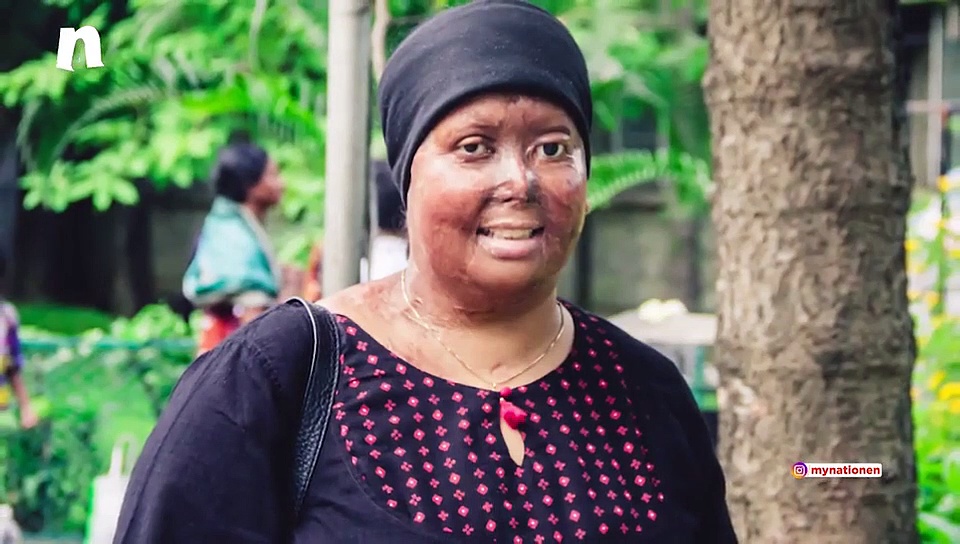 Deepika Padukone's 'Chhapaak' Brings Focus Back On Acid Attacks In India