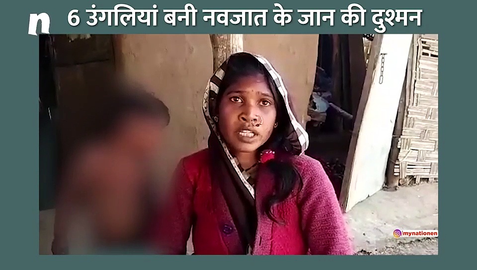 खंडवा में अंधविश्वास के कारण मां ने काटी नवजात बच्ची की उंगली