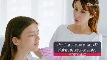 Día Mundial del Vitíligo