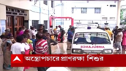 SSKM Hospital: দেড় বছরের শিশুর গলা থেকে বের হল দারুচিনি। Bangla News