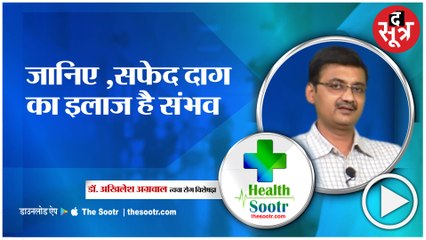 सफेद दाग नहीं फैलता छूने से Dr Akhilesh Agarwal