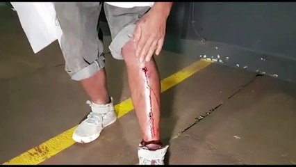 Homem afirma ter sido confundido com ladrão e espancado no Bairro Santa Felicidade