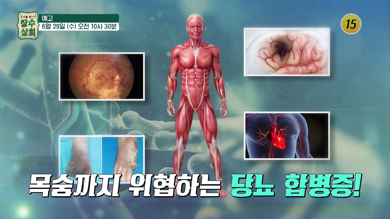 당뇨 탈출! 체지방 탈출! 건강 비법_장수상회 5회 예고 TV CHOSUN 22062...