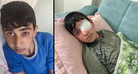 Ortaokulda görme kaybı yaşatan dayak