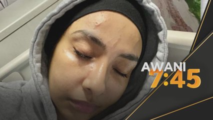 Cubaan Culik | Lufya cedera di muka ketika selamatkan anak