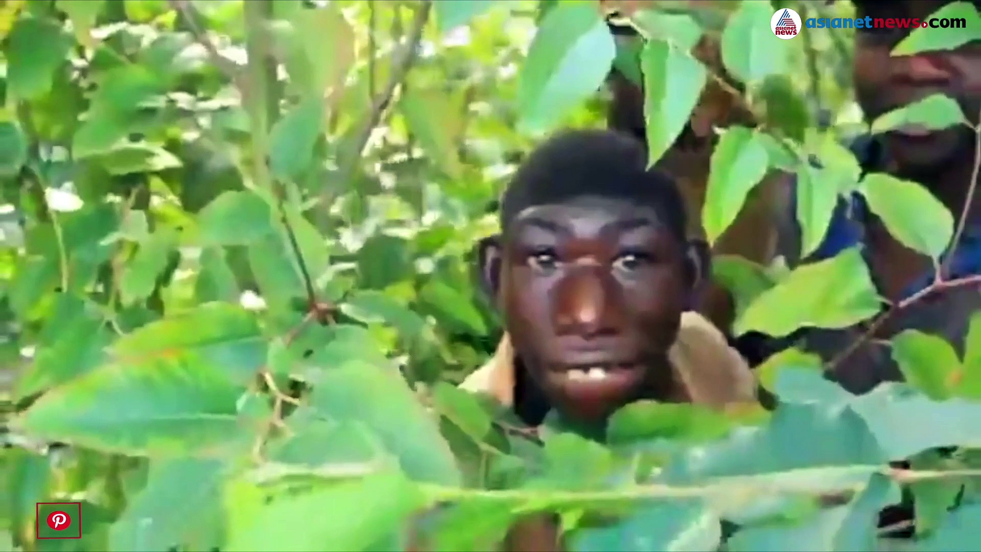 21 കാരനെ നാട്ടുകാര്‍ കുരങ്ങനെന്ന് വിളിക്കുന്നു; രക്ഷപ്പെടാനായി അവന്‍ കാടുകയറുന്നു, ഇതൊരു അത്യപൂര്‍വ കഥ