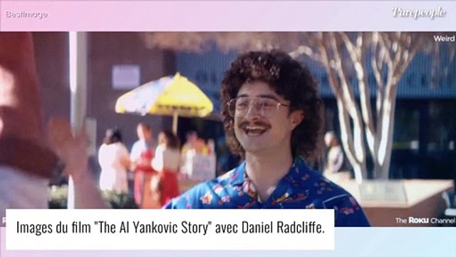 Daniel Radcliffe atteint d'une maladie rare : il a souffert pendant de nombreuses années malgré les traitements