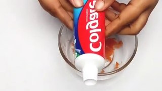 How Can You Make Your Teeth Whiter in 5 Minutes?