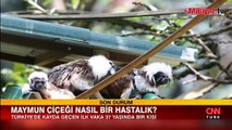 Bakan Koca: Bir hastamızda maymun çiçeği hastalığı tespit edildi