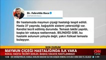 Son dakika... Bakan Koca açıkladı! Maymun çiçeği virüsü Türkiye'de