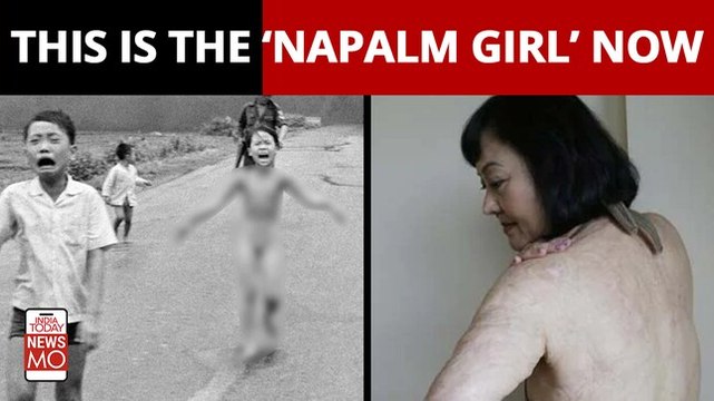 Vietnam war: After 50 years, ‘Napalm girl' in iconic Vietnam war photo gets final skin treatment in US