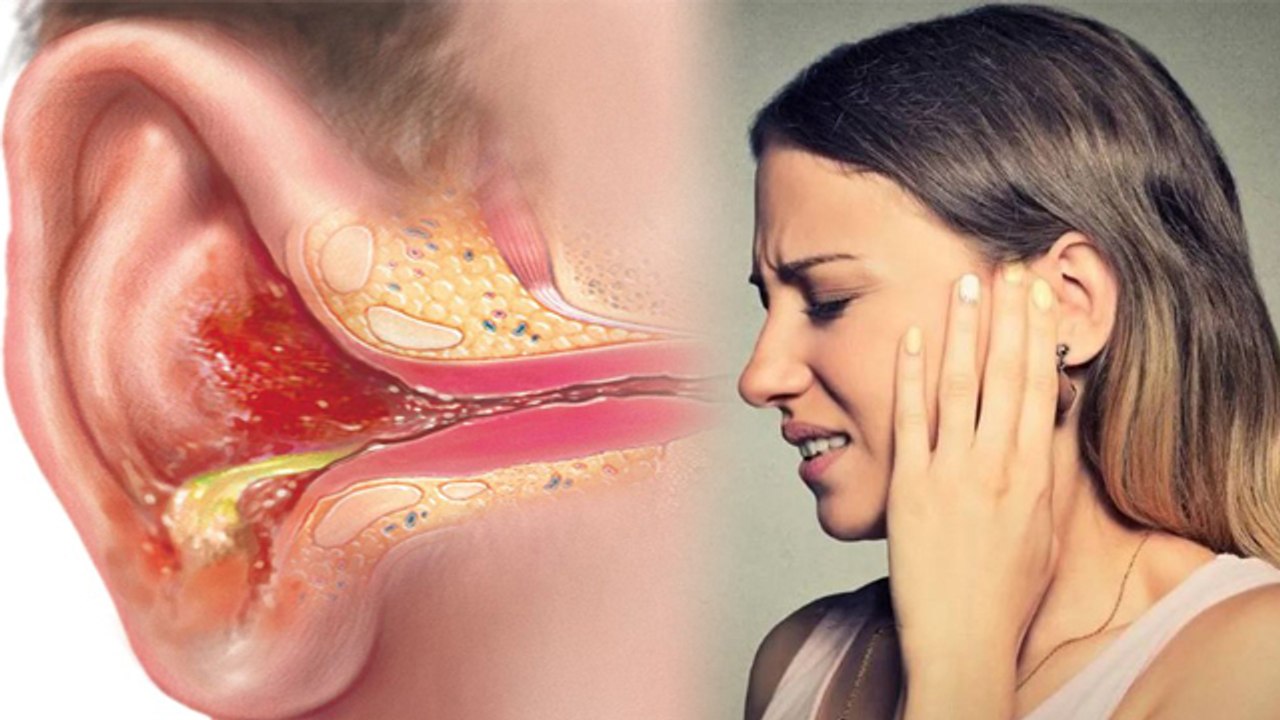 Ear Infection: बरसात में खतरनाक है कान का इंफेक...